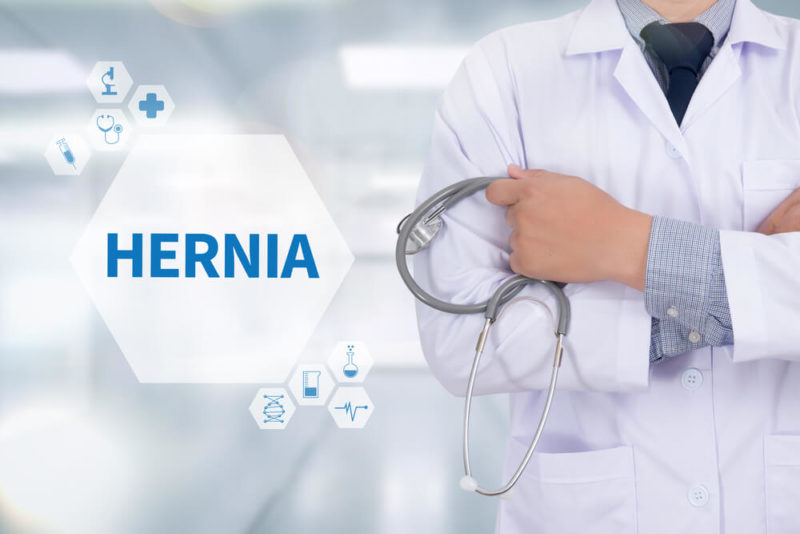 Everything You Should Know About Inguinal Hernia | Advanced Surgical ...