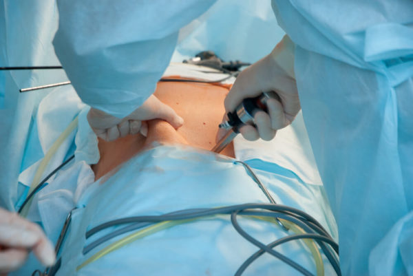 When Is Gallbladder Surgery Necessary? | Advanced Surgical Physicians