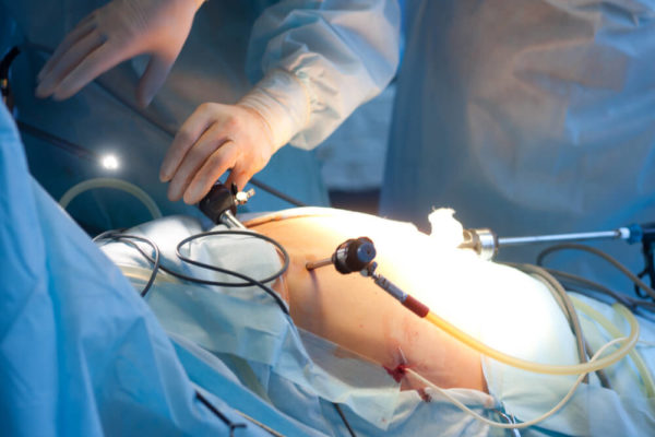 When Is Gallbladder Surgery Necessary? | Advanced Surgical Physicians