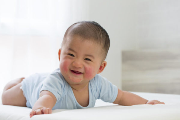 Baby Acne vs Eczema: All You Should Know About It | Ana HPMD