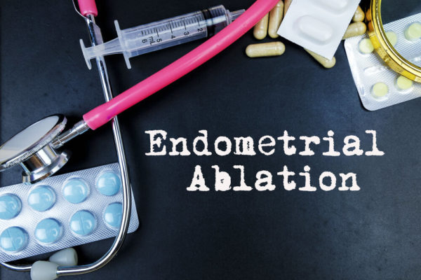 what-are-the-pros-and-cons-of-endometrial-ablation-andrew-krinsky