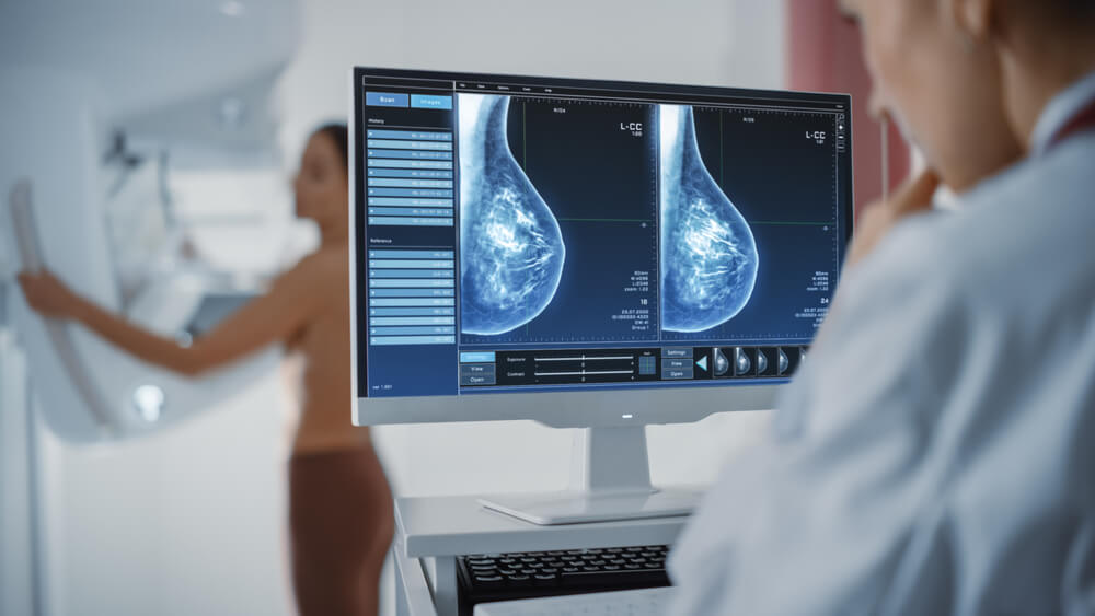 Computer Screen in Hospital Radiology Room: Beautiful Multiethnic Adult Woman Standing Topless Undergoing Mammography Screening Procedure.