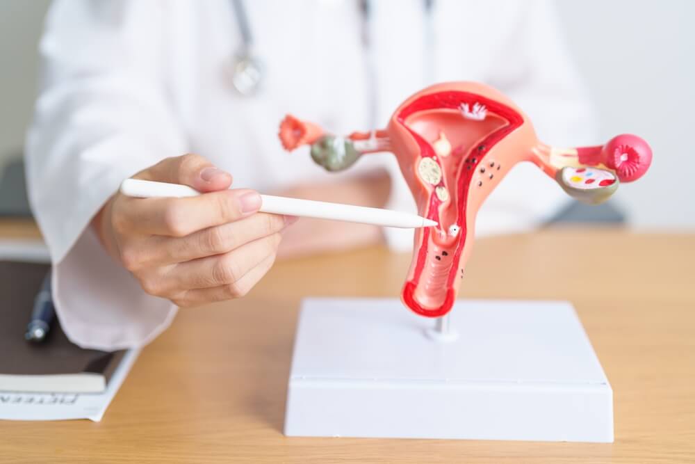 Doctor With Uterus and Ovaries Anatomy Model. Ovarian and Cervical Cancer, Cervix Disorder, Endometriosis, Hysterectomy, Uterine Fibroids, Reproductive System, Pregnancy and Health Concept