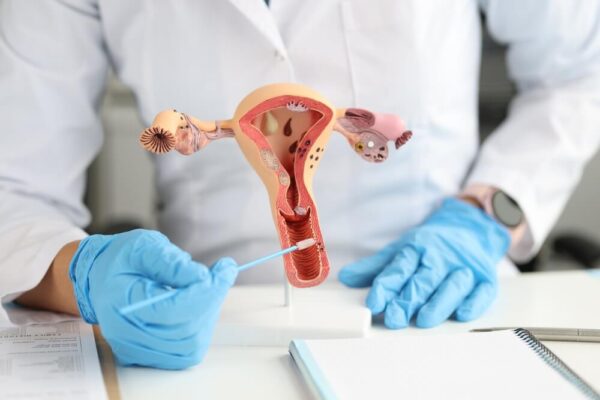 Uterine Polyp Removal: The Facts You Should Know and What to Expect ...