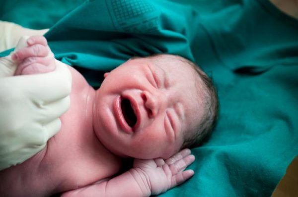 Vaginal swab could restore beneficial bacteria for C-section infants ...